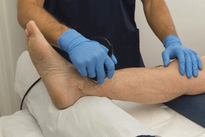 Vein Treatment Services for Monterey Area